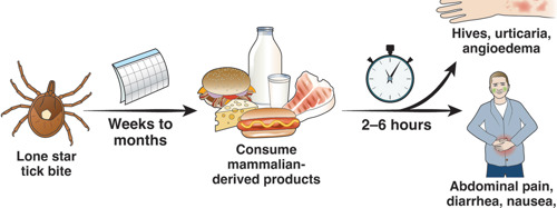 mammalian meat allergy process