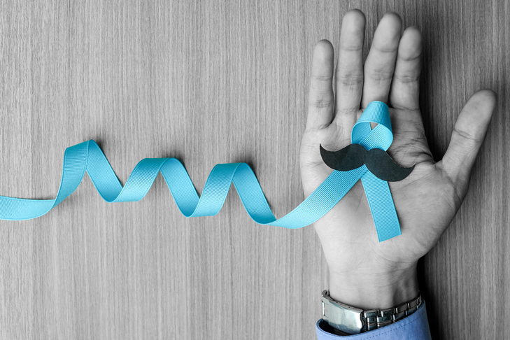 Is it time to put a CAP on the number of PSA screening tests we are doing?