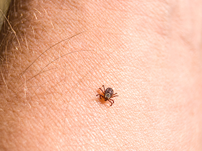 What is Mammalian Meat Allergy?