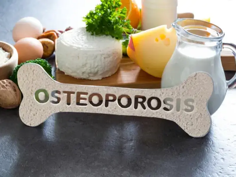 Osteoporosis in over 50s - clinical fact sheet and MCQ