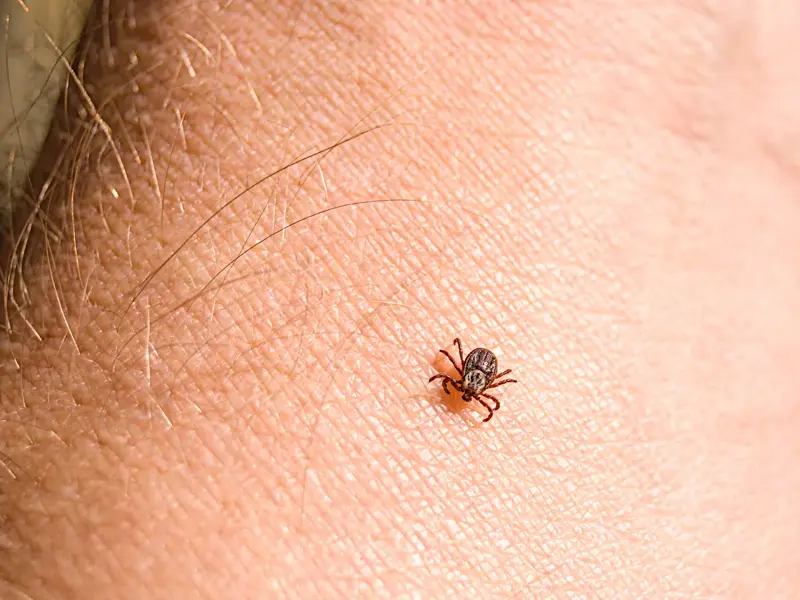 What is Mammalian Meat Allergy?