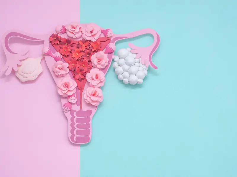 PCOS in General Practice - Podcast