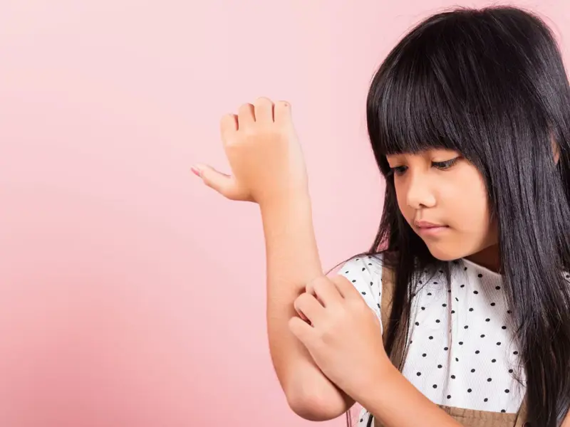 Eczema management strategies - clinical fact sheet & MCQ