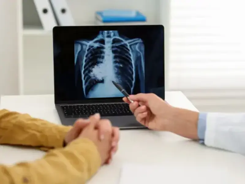 Lung cancer: screening, diagnosis, and investigation - clinical fact sheet and MCQ