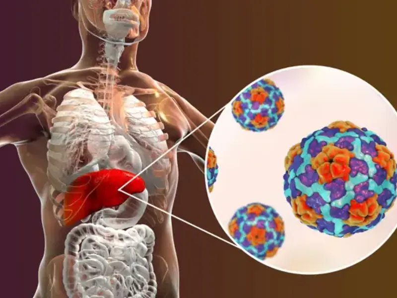 Hepatitis C - clinical fact sheet and MCQ
