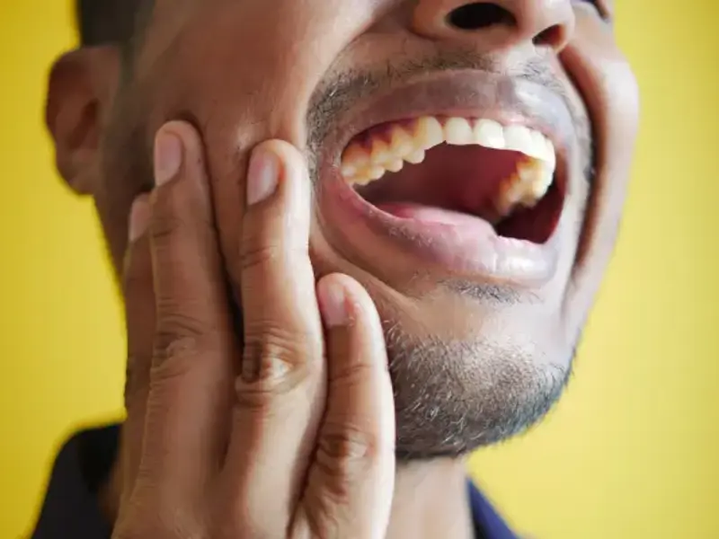 Periodontitis - clinical fact sheet and MCQ