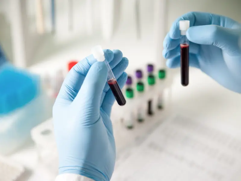 Doc, can I have the new DNA test to see if I have cancer?