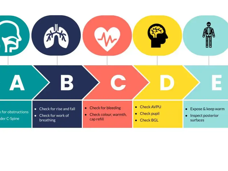 Why you should use an ABCDE approach to patient assessment