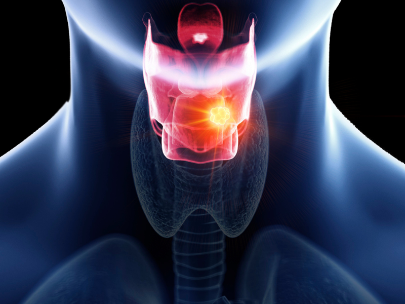 Laryngospasm - Clinical Snapshot