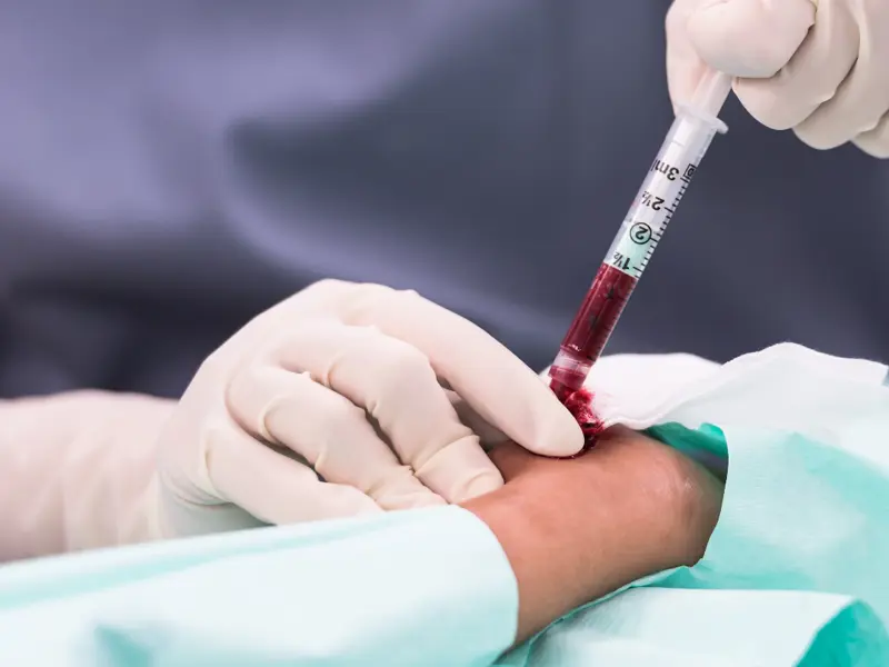 ‘When in ROME’ ABG interpretation - Clinical OPAL