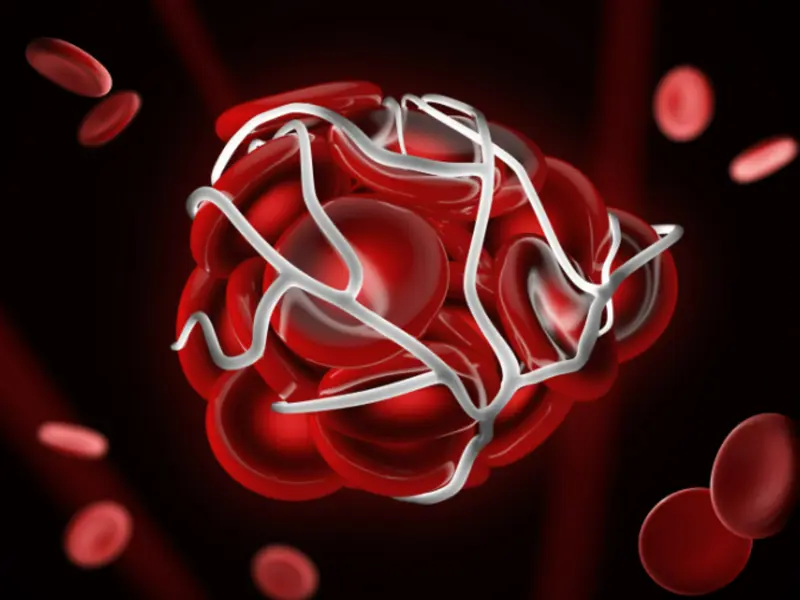 Massive Transfusion Protocol - Understanding the clotting cascade